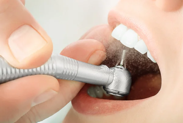 Restoration and Fillings
